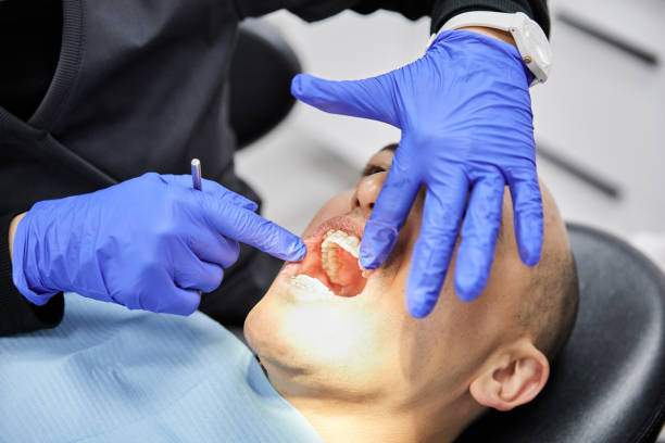 Best Emergency Dental Care for Broken or Chipped Teeth in Breckenridge Hills, MO