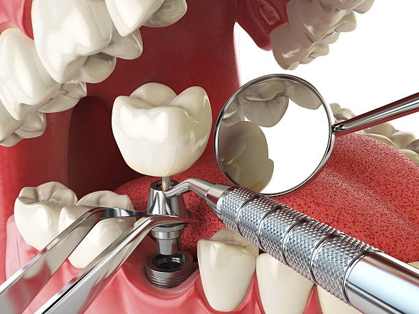 Best Same-Day Emergency Dental Services in Breckenridge Hills, MO